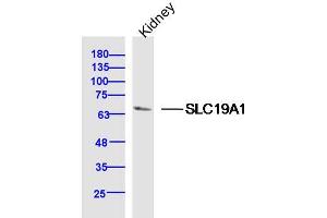 Mouse Kidney lysates probed with SLC19A1 Polyclonal Antibody, Unconjugated  at 1:300 dilution and 4˚C overnight incubation. (SLC19A1 antibody  (AA 101-200))