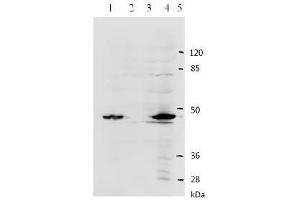 Western Blotting (WB) image for anti-Human Papilloma Virus Type 11 (HPV-11) (AA 83-201) antibody (ABIN781774) (Human Papilloma Virus Type 11 (HPV-11) (AA 83-201) antibody)