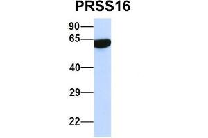 Host:  Rabbit  Target Name:  PRSS16  Sample Type:  Human 293T  Antibody Dilution:  1. (PRSS16 antibody  (Middle Region))