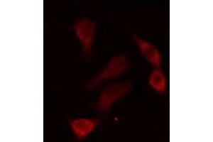 ABIN6274304 staining HepG2 cells by IF/ICC.