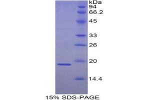 SDS-PAGE analysis of Human HSPb3 Protein.