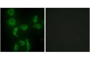 Immunofluorescence analysis of HepG2 cells, using IARS2 Antibody. (IARS2 antibody  (AA 71-120))