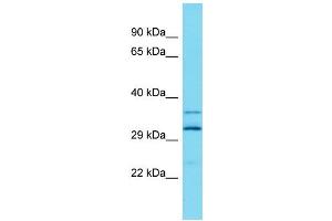 Host: Rabbit Target Name: ARL13A Sample Type: Fetal Liver lysates Antibody Dilution: 1. (ARL13A antibody  (Middle Region))