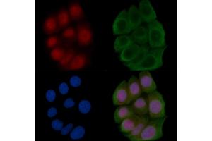ABIN6266277 and ABIN6277434 staining Hela cells(45 min of heat-shock) by IF/ICC. (TCF7 antibody  (N-Term))