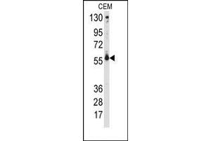Image no. 1 for anti-Cytochrome P450, Family 2, Subfamily C, Polypeptide 9 (CYP2C9) (Middle Region) antibody (ABIN360247) (CYP2C9 antibody  (Middle Region))