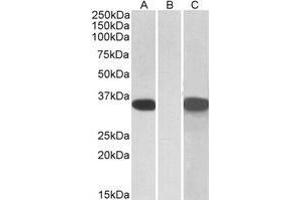 HEK293 lysate (10µg protein in RIPA buffer) overexpressing Human CRISP2 with C-terminal MYC tag probed with AP21265PU-N CRISP2 Antibody (1 µg/ml) in Lane A and probed with anti-MYC Tag (1/1000) in lane C.