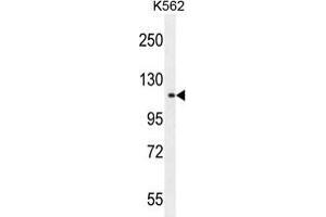 TDRD1 Antibody (C-term) western blot analysis in K562 cell line lysates (35 µg/lane). (TDRD1 antibody  (C-Term))