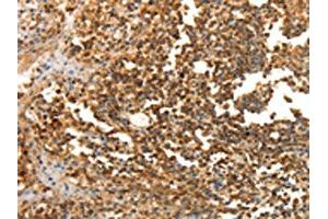 The image on the left is immunohistochemistry of paraffin-embedded Human tonsil tissue using ABIN7130100(LRP12 Antibody) at dilution 1/25, on the right is treated with fusion protein. (LRP12 antibody)