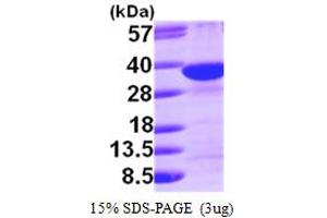 SDS-PAGE (SDS) image for Syndecan Binding Protein (Syntenin) (SDCBP) (AA 1-298) protein (His tag) (ABIN667285)