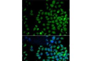 Immunofluorescence analysis of A-549 cells using UBD Polyclonal Antibody (UBD antibody)