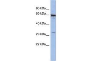 Image no. 1 for anti-Melanoma Antigen Family A, 9 (MAGEA9) (C-Term) antibody (ABIN6742783) (MAGEA9 antibody  (C-Term))