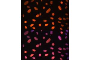 Immunofluorescence analysis of U-2 OS cells using ZNF581 Polyclonal Antibody (ABIN6128960, ABIN6150520, ABIN6150521 and ABIN6217055) at dilution of 1:100 (40x lens). (ZNF581 antibody  (AA 1-90))