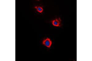 Immunofluorescent analysis of Adenylate Cyclase 5/6 staining in Raw264. (ADCY5/6 antibody  (C-Term))