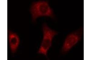 ABIN6277815 staining Hela cells by IF/ICC. (Caspase 4 antibody)