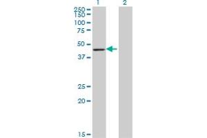 Western Blotting (WB) image for anti-ADP-Ribosylation Factor Interacting Protein 1 (ARFIP1) (AA 1-101) antibody (ABIN525909)