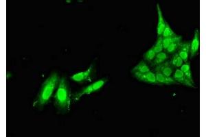 Immunofluorescent analysis of Hela cells using ABIN7161031 at dilution of 1:100 and Alexa Fluor 488-congugated AffiniPure Goat Anti-Rabbit IgG(H+L) (Nanos Homolog 1 antibody  (AA 1-292))