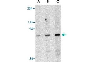 Western blot analysis of DDX58 in C2C12 cell lysate with DDX58 polyclonal antibody  at (A) 0. (DDX58 antibody)
