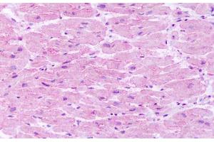 TACR1 antibody  (C-Term)