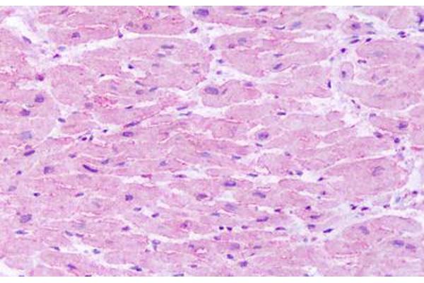 TACR1 antibody  (C-Term)