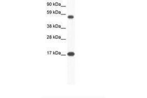 Image no. 1 for anti-Zinc Finger Protein 554 (ZNF554) (AA 141-190) antibody (ABIN6736043) (ZNF554 antibody  (AA 141-190))