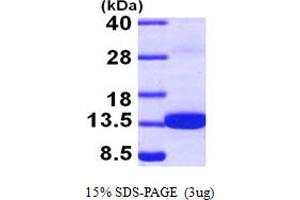 SDS-PAGE (SDS) image for S100 Calcium Binding Protein Z (S100Z) (AA 1-99) protein (His tag) (ABIN667018)
