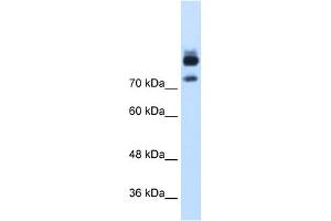 WB Suggested Anti-MTMR1 Antibody Titration:  1. (MTMR1 antibody  (C-Term))