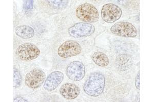 Immunohistochemistry (IHC) image for anti-DEAD (Asp-Glu-Ala-Asp) Box Polypeptide 46 (DDX46) (C-Term) antibody (ABIN7448521)