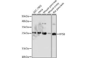 Western blot analysis of extracts of various cell lines, using RPS8 antibody (ABIN7270041) at 1:1000 dilution. (RPS8 antibody)