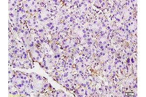Formalin-fixed and paraffin embedded rat pancreas tissue labeled with Anti-CD105 Polyclonal Antibody, unconjugated(ABIN707561) at 1: 200 followed by incubation with conjugated secondary antibody and DAB staining (Endoglin antibody  (AA 58-110))