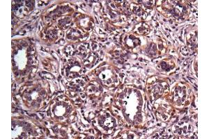 Immunohistochemistry (IHC) image for anti-Epidermal Growth Factor Receptor (EGFR) (N-Term) antibody (ABIN2854848)