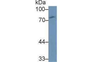 Detection of CD97 in Human U87MG cell lysate using Monoclonal Antibody to Cluster Of Differentiation 97 (CD97) (CD97 antibody  (AA 58-260))