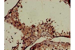 CNKSR2 antibody  (AA 650-800)