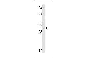 Western blot analysis of Calponin-1 Antibody (N-term) (ABIN390766 and ABIN2841024) in NCI- cell line lysates (35 μg/lane). (CNN1 antibody  (N-Term))