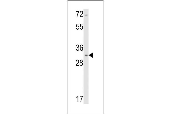 CNN1 antibody  (N-Term)