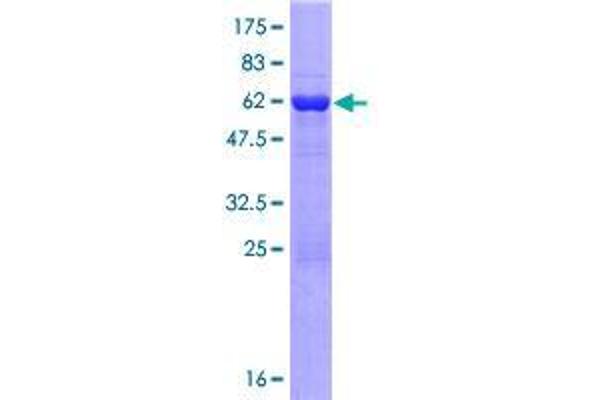 TBC1D21 Protein (AA 1-336) (GST tag)