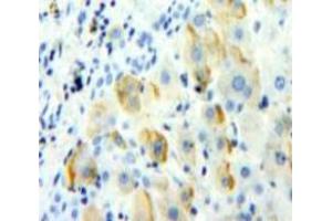Used in DAB staining on fromalin fixed paraffin-embedded Liver tissue (TREM1 antibody  (AA 21-205))