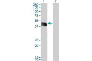 Western Blot analysis of GENX-3414 expression in transfected 293T cell line by GENX-3414 monoclonal antibody (M03), clone 4H4. (STBD1 antibody  (AA 1-358))