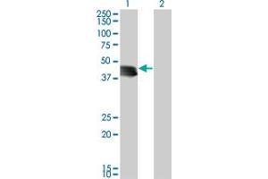 Western Blot analysis of GENX-3414 expression in transfected 293T cell line by GENX-3414 monoclonal antibody (M03), clone 4H4.