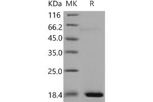 Western Blotting (WB) image for Regenerating Islet-Derived 3 alpha (REG3A) protein (His tag) (ABIN7320383) (REG3A Protein (His tag))