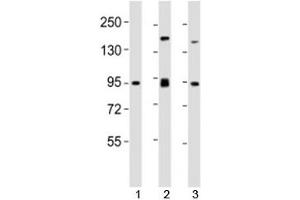 Western blot testing of SUZ12 antibody at 1:2000 dilution. (SUZ12 antibody  (AA 375-408))