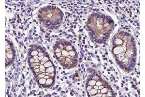 ABIN6268764 at 1/100 staining human colon tissue sections by IHC-P. (Claudin 5 antibody)