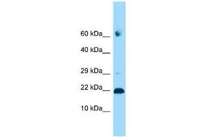 WB Suggested Anti-ADAT2 Antibody Titration: 1. (ADAT2 antibody  (C-Term))