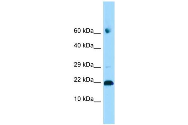 ADAT2 antibody  (C-Term)