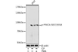 Western blot analysis of extracts of various cell lines, using Phospho-PKC alpha-S657/Y658 Rabbit pAb (ABIN7269630) at 1:1000 dilution. (PKC alpha antibody  (pSer657, pTyr658))