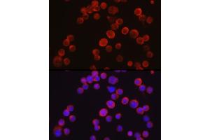 Immunofluorescence analysis of Jurkat cells using Tec Rabbit pAb (ABIN6128353, ABIN6148988, ABIN6148989 and ABIN6213654) at dilution of 1:50 (40x lens). (NR4A3 antibody  (AA 1-280))