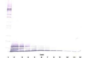Image no. 3 for anti-Chemokine (C-C Motif) Ligand 5 (CCL5) antibody (ABIN465617) (CCL5 antibody)