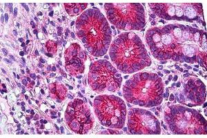 Human Small Intestine: Formalin-Fixed, Paraffin-Embedded (FFPE) (RHOH antibody  (AA 141-190))