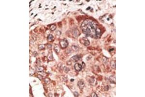 Image no. 2 for anti-Recoverin (RCVRN) (C-Term) antibody (ABIN357114) (Recoverin antibody  (C-Term))