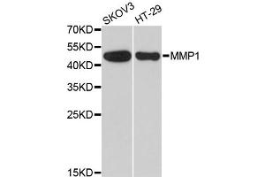 Western blot analysis of extracts of various cell lines, using MMP1 antibody. (MMP1 antibody)