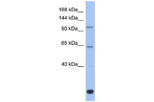 Western Blotting (WB) image for anti-BTB and CNC Homology 1, Basic Leucine Zipper Transcription Factor 2 (BACH2) (Middle Region) antibody (ABIN2777818)